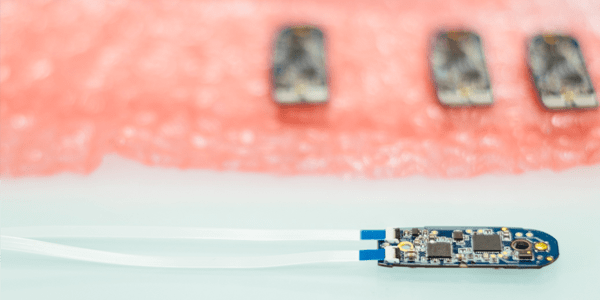Orosound est lauréate INNOV’up Proto 2016